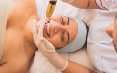 Comparing At-Home vs. Professional Microneedling Treatments
