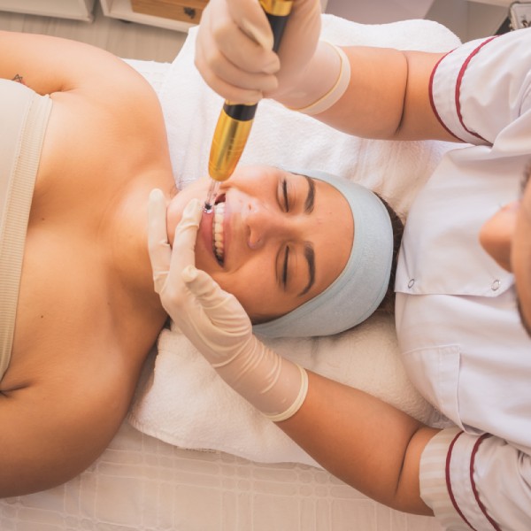 A woman lying on a table and smiling while an aesthetician stands over her and performs microneedling on her face.